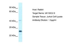 APOBEC3D Rabbit anti-Human, Polyclonal, Novus Biologicals 0.1ml; Unconjugated:Antibodies,